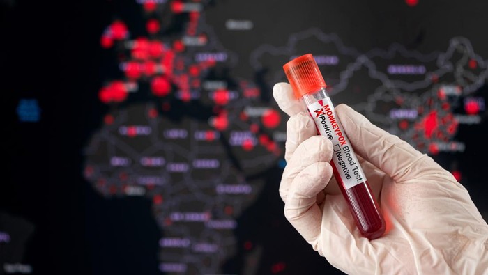 Cacar Monyet Masuk Indonesia dan 5 Hal yang Perlu Diketahui