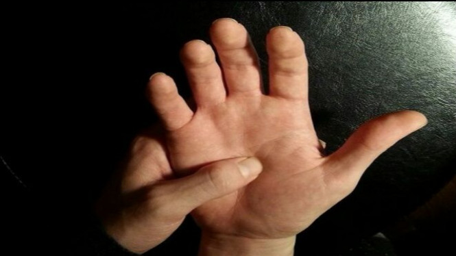 Sembuhkan 7 Penyakit Umum Ini Hanya dengan Pijat Tangan