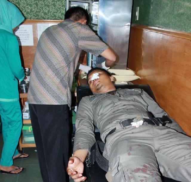 Niat Tertibkan Anak Punk, Anggota Satpol PP Pekanbaru Dilempari Batu Hingga Alami Luka Robek