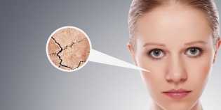 Ini Lima Makanan Sehat yang Bisa Mengatasi Masalah Kulit Kering