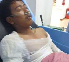 Pekerja Internet di Pekanbaru Tersengat Listrik, Tubuh Terbakar 46 Persen