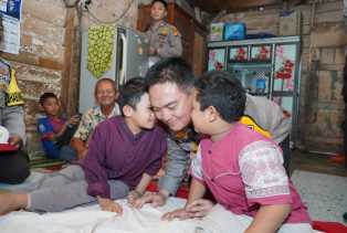 Dibiayai Kapolda Riau, Adik-Kakak Penderita Tulang Kaca Berangsur Pulih