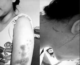 Korban Penganiayaan Oknum Polwan Dilaporkan ke Polda Riau Terkait UU ITE