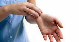 Virus Cacar Monyet Bisa Menular lewat Tempat Tidur hingga Handuk