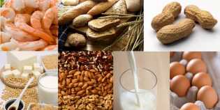 Waspadai, Makanan-Makanan Ini Dapat Memicu Alergi