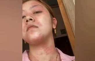 Ini Deretan Orang yang Dilarang Keras Suntik Putih, Siapa Saja?