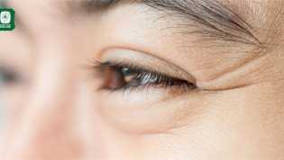 Apa Arti Kedutan Mata Kanan Bawah Menurut Islam? Ini Penjelasannya