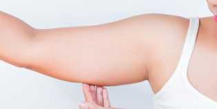 Lima Cara Mengatasi Lemak yang Menggelambir di Pangkal Lengan