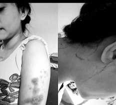 Ngaku Dianiaya Seorang Oknum Polwan, Unggahan Wanita ini Viral di Medsos