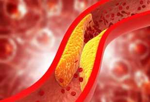 Kolesterol Naik Akibat Kebanyakan Makan Gorengan, Kenali Gejalanya