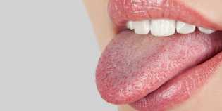 Yuk, Kenali Masalah Kesehatan yang Dialami dari Kondisi Lidah yang Kamu Miliki